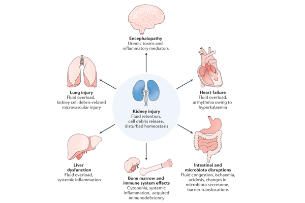 4.acute kidney injury