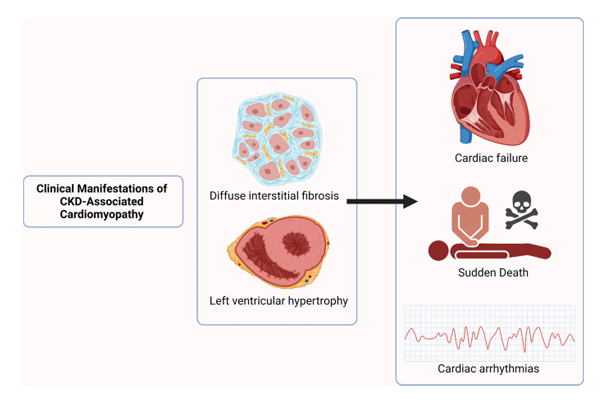 3.hypertension kidney disease