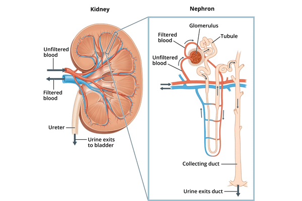 1. Nephrotic Syndrome