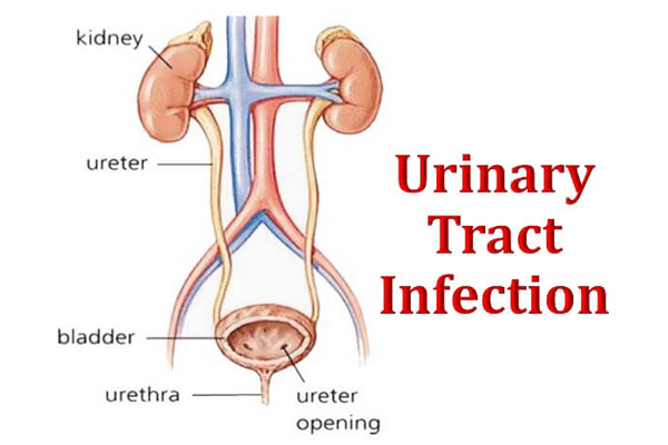 4.uti